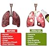 Herbal Lung Cleansing Spray